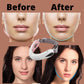 BDV Double Chin Remover, EMS Facial Massager, Light Therapy, Slimming and Face Lift, Microcurrent RF Face Lift, Beauty Machine