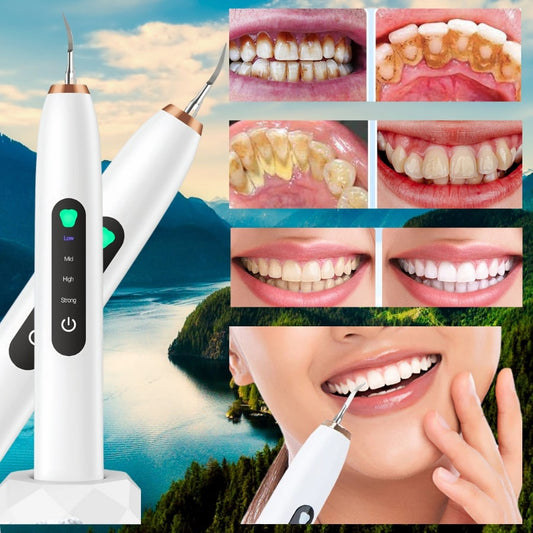 BDV Dental Scaler with wireless display, HD endoscope, 6 LED charging base and shadowless light - for effective removal of tartar, plaque, stains, smoke and food odors
